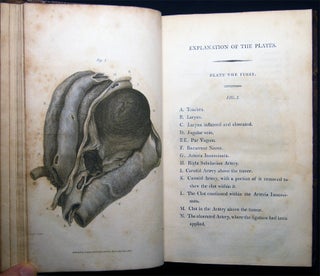 Medico-Chirurgical Transactions, Published By the Medical and Chirurgical Society of London. Volume the First.