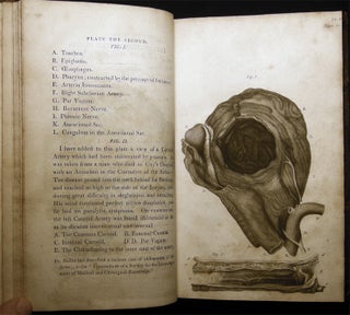 Medico-Chirurgical Transactions, Published By the Medical and Chirurgical Society of London. Volume the First.